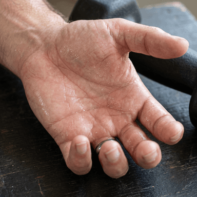 Sweaty hand